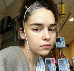 Эмилия Кларк впервые показала фото из больницы после инсульта 