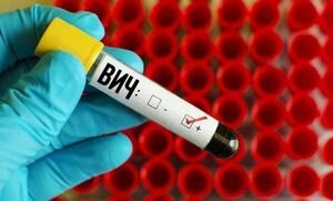 Ученые разработали действенную экспериментальную вакцину от ВИЧ