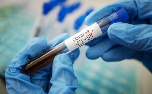 В Минздраве сообщили, где начнут ИФА-тестирование на антитела к COVID-19