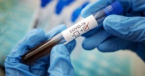 У Києві коронавірусом захворіли 20 медиків БСП
